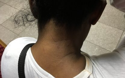 Overgrown bushes on neglected house lots drive fear into neighbours