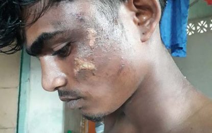 Cops accused of throwing hot water on suspected house jumper