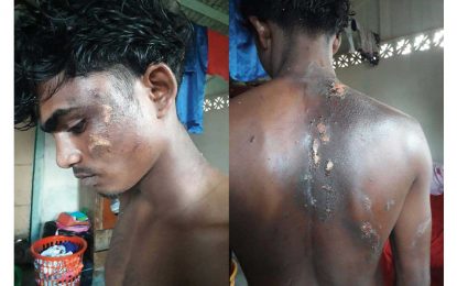 Cops to be charged with abduction, felonious wounding of suspected burglar