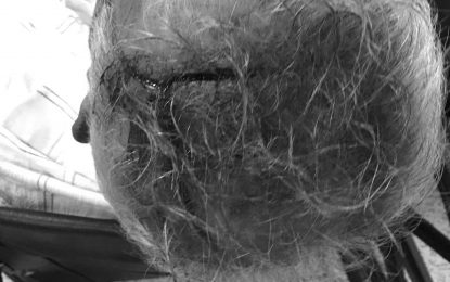 Man, 72, hospitalised after beating by son’s employer