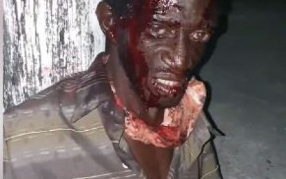 Masked bandit uses steel chain to beat man after robbing him