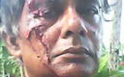 Farmer chopped with own cutlass for confronting trespasser