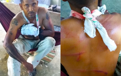 Man says co-workers were part of violent protest that beat and chopped him