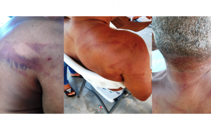 Miner abandoned by taxi driver after beaten, robbed by protesters