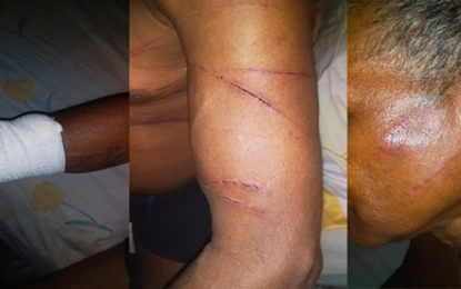 Man stripped, car burnt in protest attack at Mahaicony