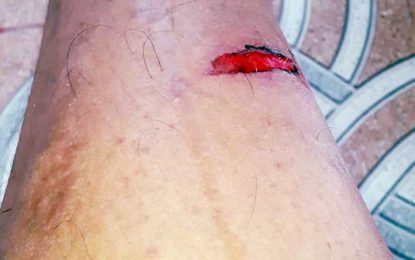 Tailor shot in the foot during suspected armed robbery
