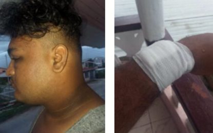 Photographer robbed, chopped after photoshoot