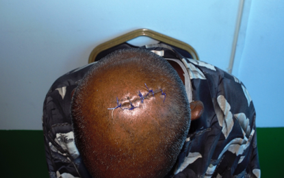 Juveniles chop man for advising them on relationship