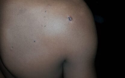 Boy, 13 shot in Aruka River ‘crossfire’