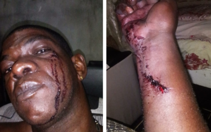 Businessman’s son charged with assaulting customer with beer bottles