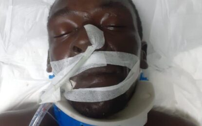 Pedal cyclist critical after hit down by Health Ministry’s bus – Victim unidentified