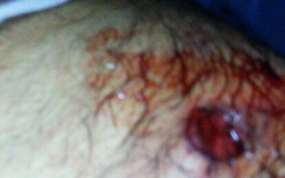 Businessman shot, robbed at Eccles traffic light