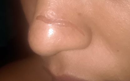 Another woman comes forward, claims she was abducted, brutalized by serial rapist