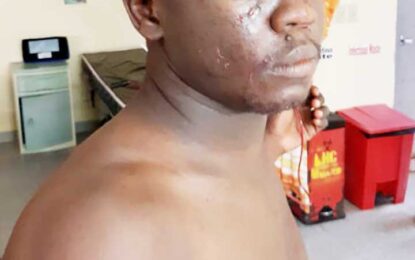 GDF ranks beaten, stabbed by civilians at Linden party