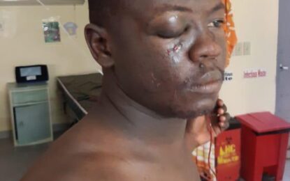 Two police ranks being questioned over wounding of GDF ranks