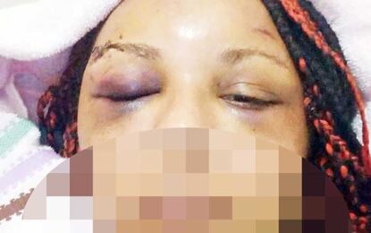 ‘Spanish’ woman raped, sodomised, battered  as neighbour rushed to get help