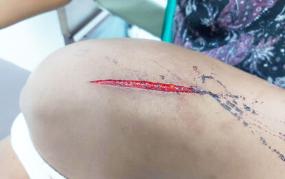 Girl, 13, slashes uncle with surgical blade for scolding her