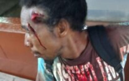 Man placed on bail for wounding logger who approached him to fight