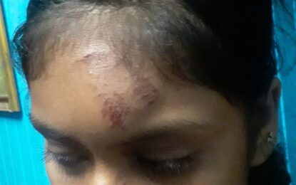 Grove woman beaten, slashed, stoned over name-calling argument