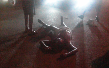 Vagrant injured after struck down by car