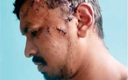 Neighbours charged for assaulting each other with dinnerware