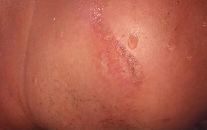 Men who refused to pay for hotdogs beat vendor, steal cash