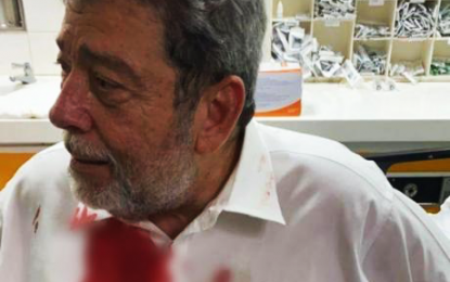 St. Vincent’s Prime Minister injured amid massive protest