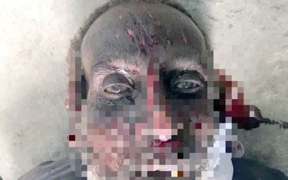 Police forced to quickly dispose of unidentified bodies to cut cost