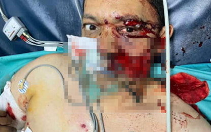 Executed businessman’s friend still critical