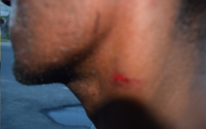 Housing ministry employee stabs man with car key, snatches his phone after minor accident