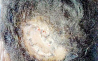 Woman brutally chopped to head by ex-boyfriend