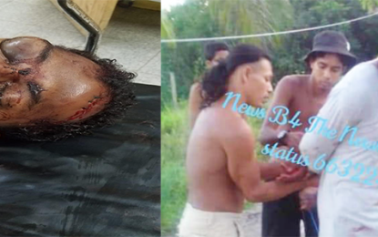 Linden man who attacked reputed wife, critical following vigilante beating