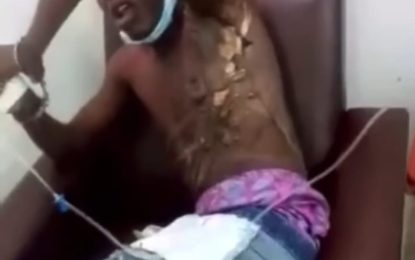 Three cops face disciplinary charges for alleged torture of teen while in police custody