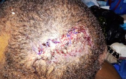 Prime suspect held for beating businessman, son