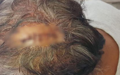 Toy gun bandit slams shop owner’s head with scale weight during robbery