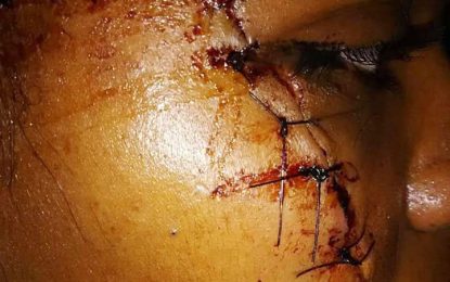 Farmer gets 10 years for attempting to murder ex-wife