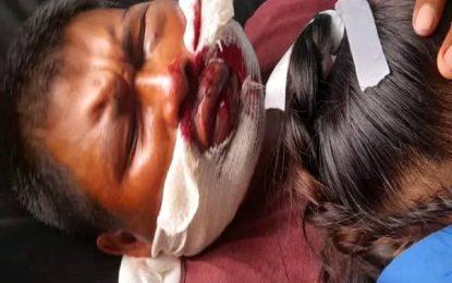 GDF boat collided with San Martin boat captain causing injuries – Police