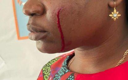 Gang invasion at Linden school leaves teacher injured