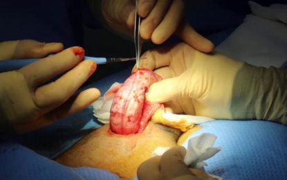 Acceptance of Natural Confidence – Rethinking Surgical Penis Enlargement for Men