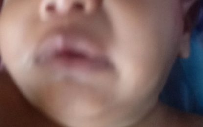 Six-month-old baby critical after hitting head on rock