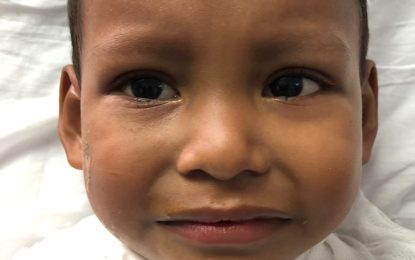 Boy, 3, reportedly falls into pot of boiling water