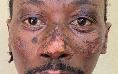 Linden arson: Man remanded for murder of sister, niece