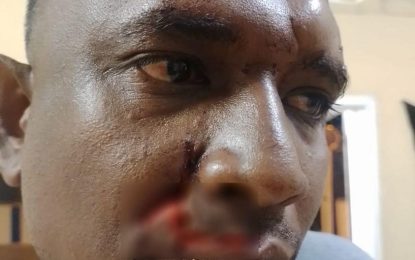 Enmore man beaten at wedding house