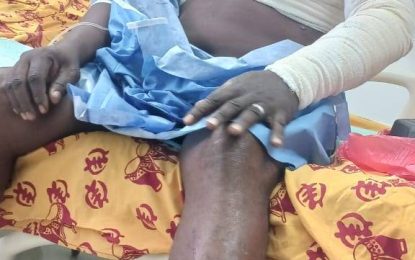 Woman flees after setting lover and his shop on fire