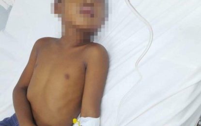 Toddler who was badly beaten by stepfather shows signs of improvement 