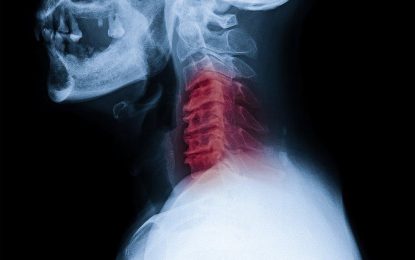 Thief breaks neck breaking into home  