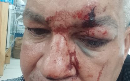 ‘Bryan Max’ attackers identified as PPP/C councilors