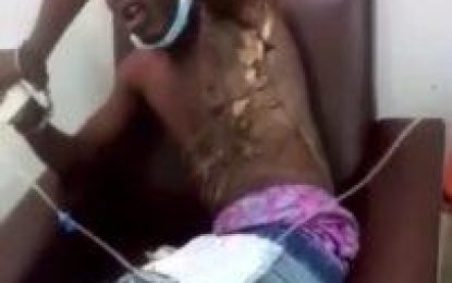 Teen tortured by police sues State for $150 million