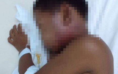 Police yet to arrest man who allegedly brutalized stepson