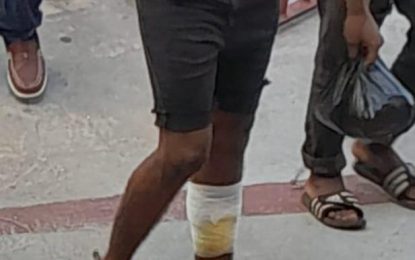 Repeat offender on $3.7M bail for two counts of armed robbery